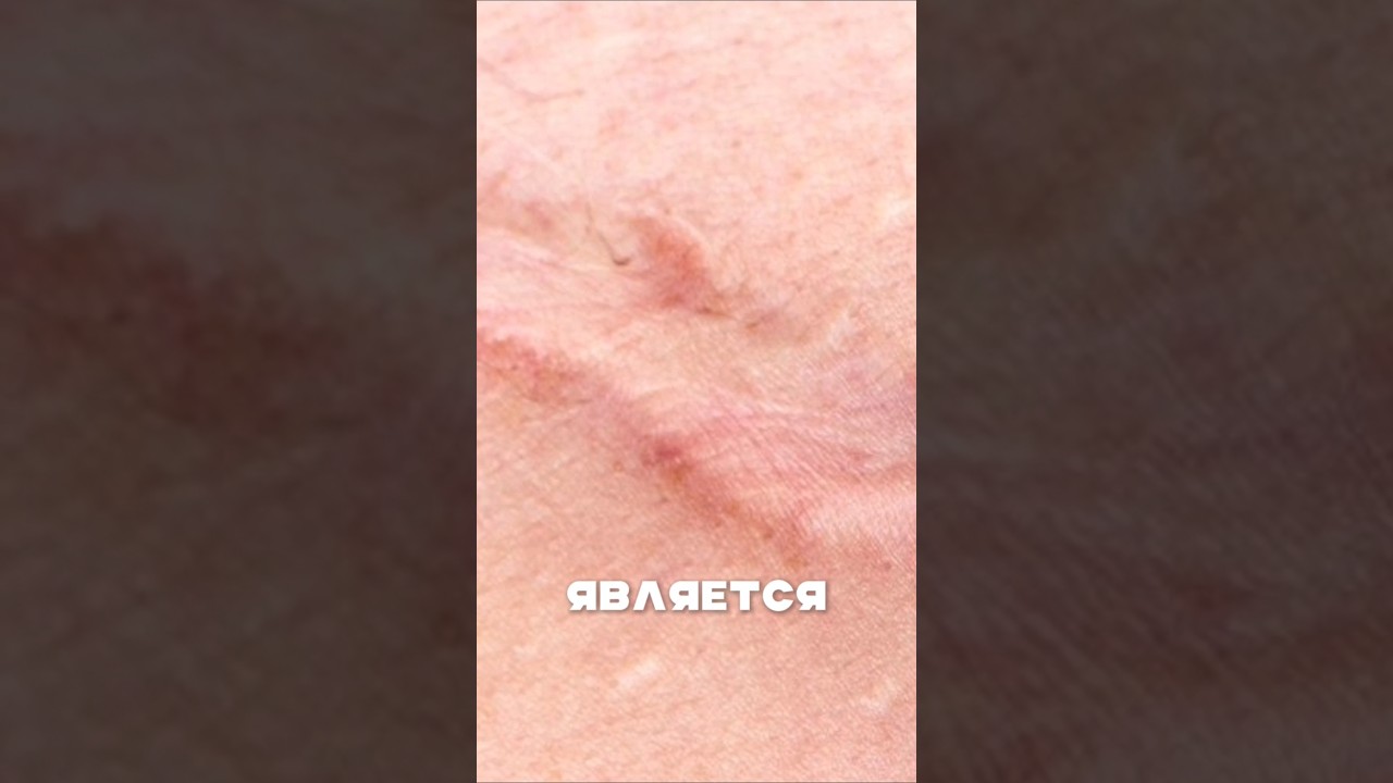 Топ препаратов для восстановления кожи #shorts