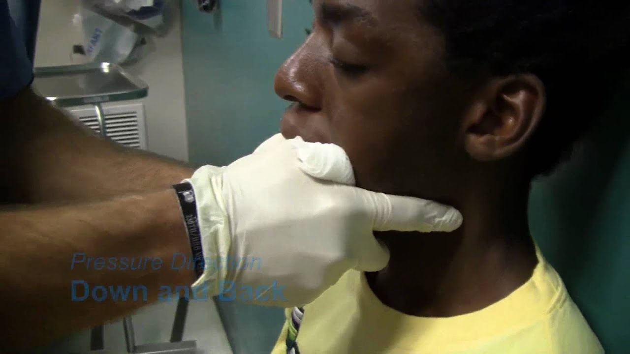 Pediatric Jaw Dislocation Reduction - YouTube