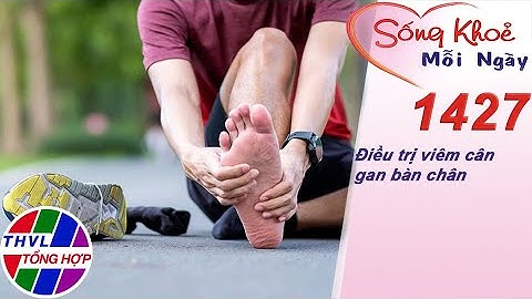 Điều trị viêm cân gan bàn chân ​| Sống khỏe mỗi ngày - Kỳ 1427