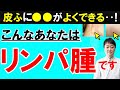 【放置禁止】日本で急増する血液がん「悪性リンパ腫」の7つの初期症状　しこりだけでなく起こる皮ふ等の変化とは？　専門医師がくわしく解説