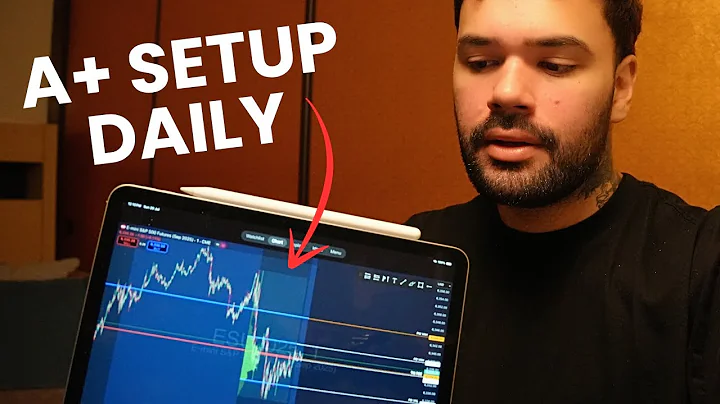 Finding an A+ Volume Profile Trade Setup Every Day