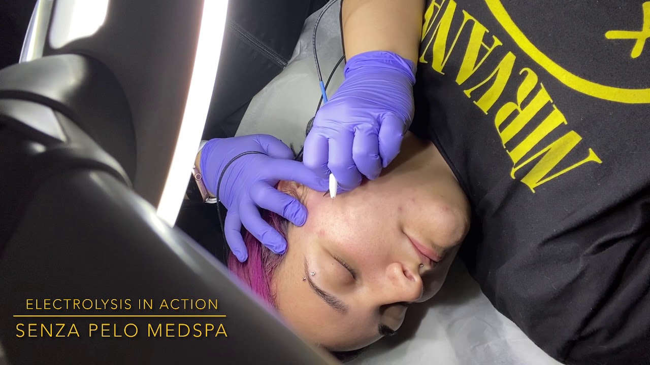 Electrolysis in Action