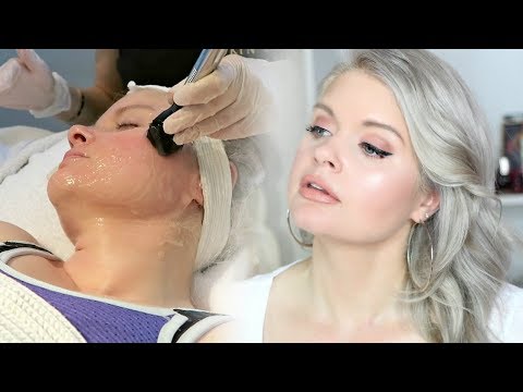 Non Surgical Facelift For Neck | Forma Skin Tightening Review | Skin Spa New York Back Bay