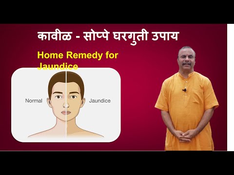 काविळीसाठी काही सोप्पे घरगुती उपाय / Home Remedy for Jaundice / Kavil Ayurved upay दामले उवाच