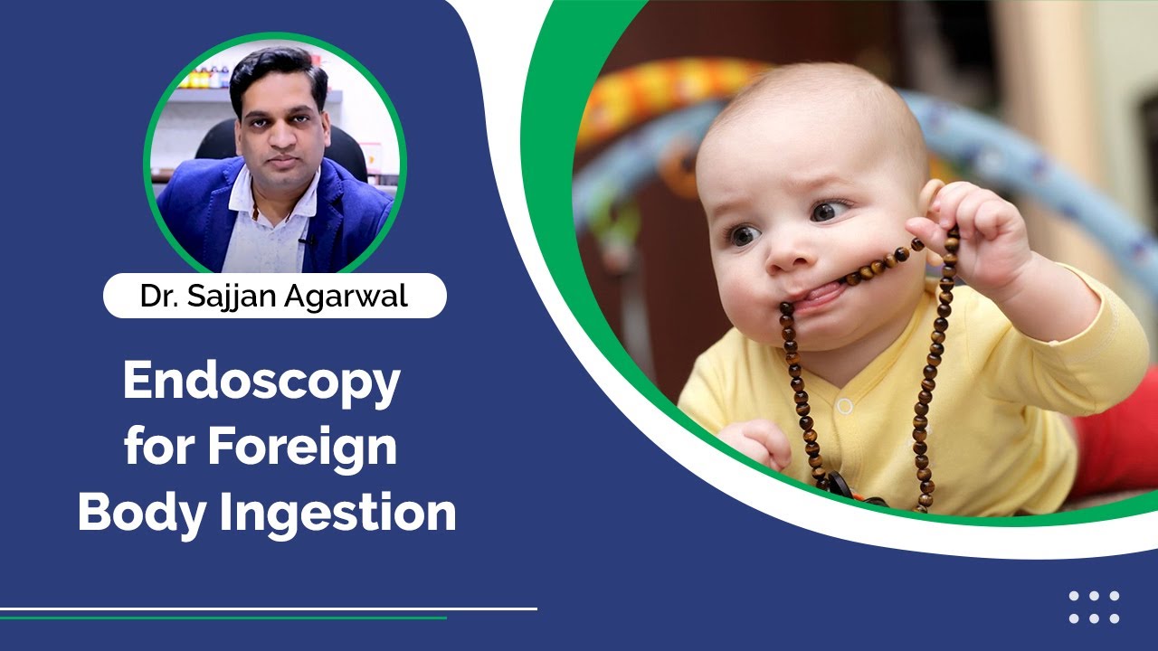 Endoscopy for Foreign Body Ingestion | Babylon Hospital