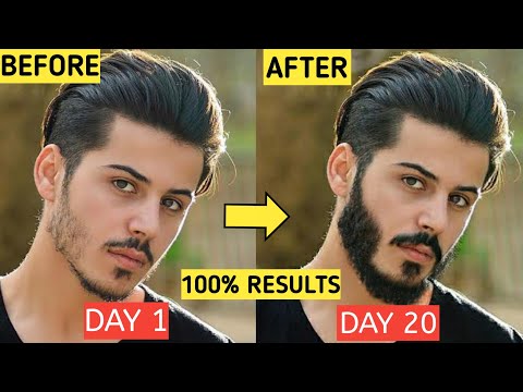 5 ULTIMATE BEARD Growth Hacks For Teenagers At Home *100% RESULTS* | Patchy Beard Solution In Hindi