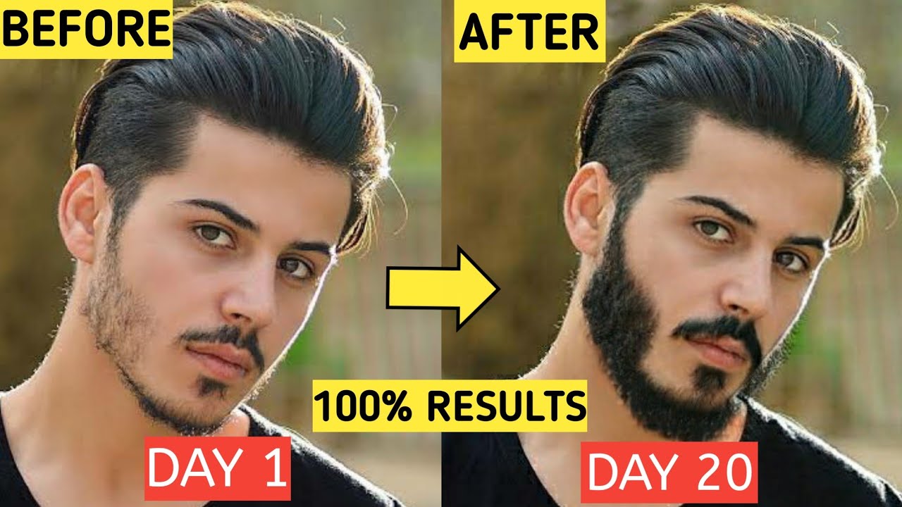 5-ultimate-beard-growth-hacks-for-teenagers-at-home-100-results