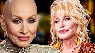 Dolly Parton Reveals Her Real Hair & Why She Wears Wigs
