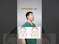 Face collapse big and small face temple depression go to practice facial yoga gal#Facial