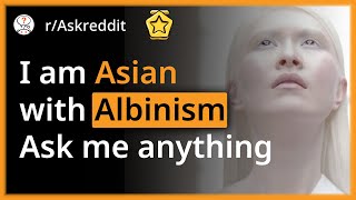 Information I am an ALBINO ASIAN - Reddit Ask Me Anything News