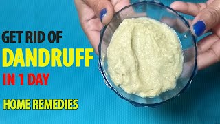 सिर्फ 1 दिन में हमेशा के लिए रूसी हटाने का घरेलू उपाय | Remove Dandruff in 1 wash | 100% Natural