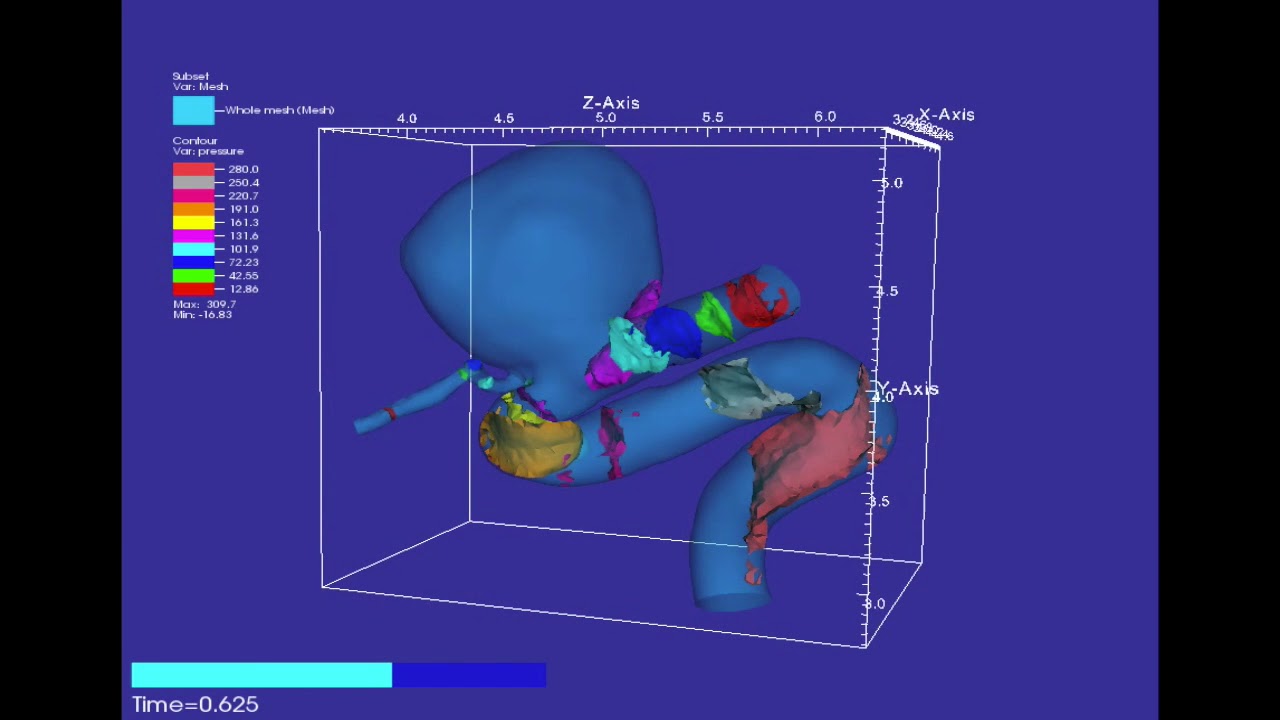 Blood Flow in an Aneurysm