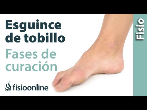 Sensacion de calor en el brazo izquierdo