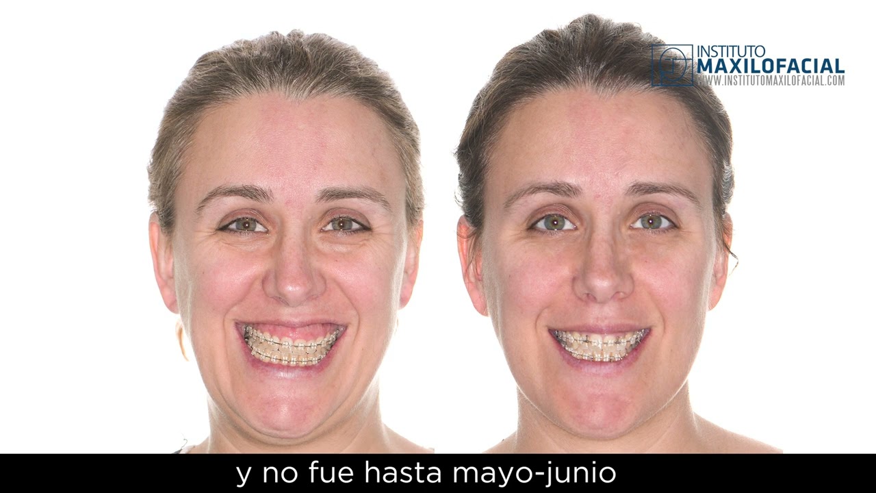 Cirugía Estética Facial - Instituto Maxilofacial