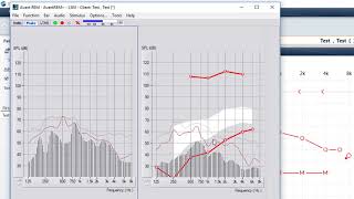 REM 7 Peak Sounds