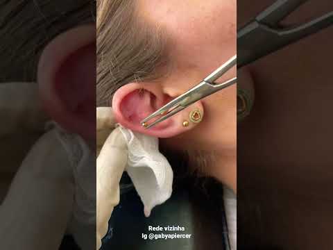 Vídeo: 3 maneiras de limpar um piercing de orelha infectado