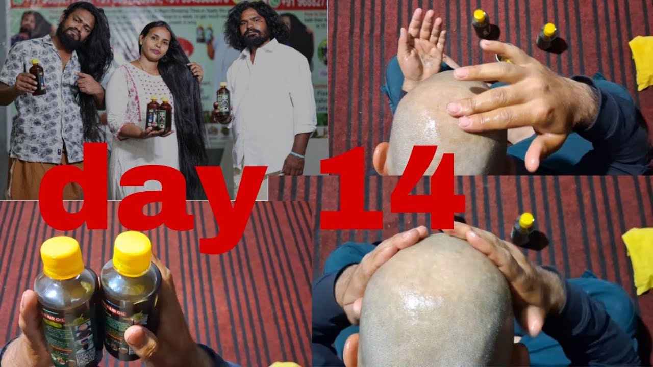 adivasi oil hair growth day 14 || aadivasi  neelambari oil review || adivasi hair oil honest review