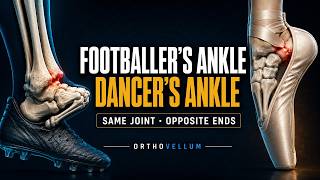 Footballer's Ankle vs Dancer's Ankle — Ankle Impingement Explained