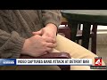 One band mate in the ER, Video captures band attack at Detroit Bar.