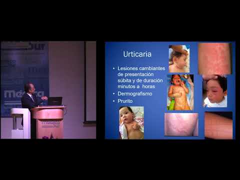Dr. Ernesto Onuma Takane. Utilidad de los perfiles diagnósticos en alergia