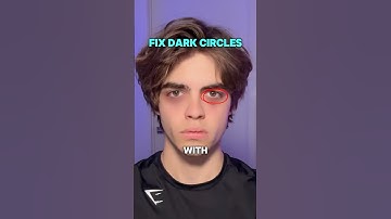 How to fix eye bags and dark circles 😱