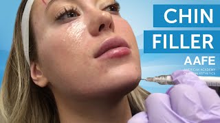 Creating a Balanced Profile with Chin Filler | AAFE