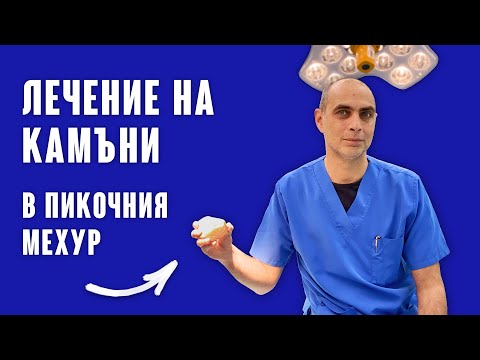 Камъни в Пикочния Мехур... Кой е най-добрият метод за лечение и разбиване?!