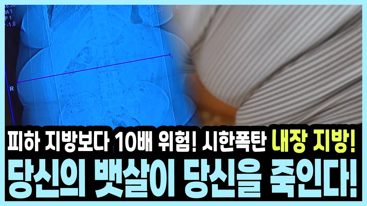 [나잇살의 경고] 뱃살에도 '독(毒) 뱃살'이 있다! 당뇨·심혈관 질환·암까지 부르는 내장 지방 제거 비법 대공개! I KBS 20180401 방송