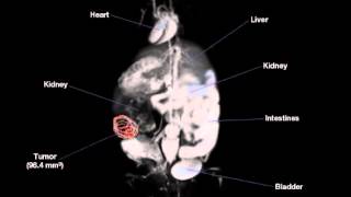 Volumetric Measurement Of Ovarian Tumor In Mouse