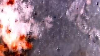 Famous Egg Shell from a Sparrow Under microscope. egg is grey with naked eye Net Worth