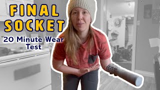 FINAL SOCKET FITTING + WEAR TEST // New Prosthetic Soon?!