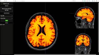 Celebrity Saliency Inference Wealth