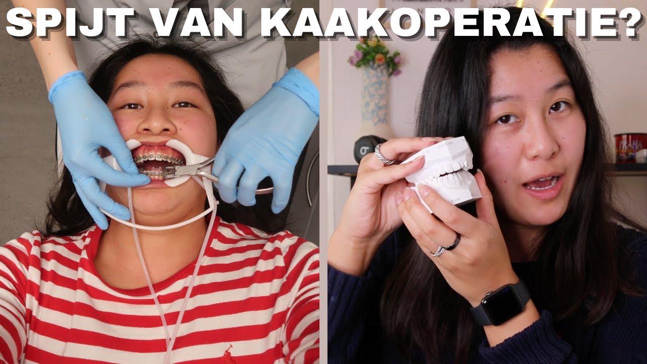 BEUGEL ERUIT Na 2,5 Jaar & Kaakoperatie 😱 + Q&A YouTube BEUGEL ERUIT Na 2,5 Jaar & Kaakoperatie 😱 + Q&A YouTube