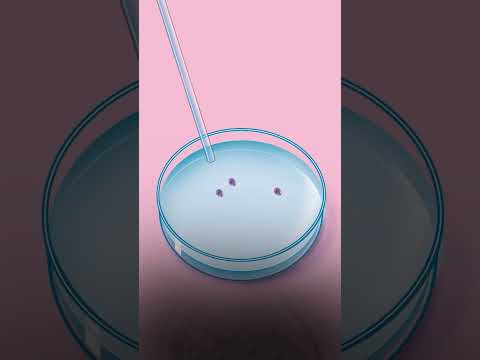 How Long Does it take to get Pregnant with IVF | CM Hospital | Nanganallur - Video Editing Services Chennai | MS MediaCorp