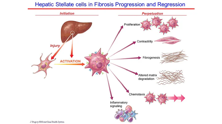 Deciphering Fibrosis: Drivers of Fibrotic Disease in the Liver and Heart