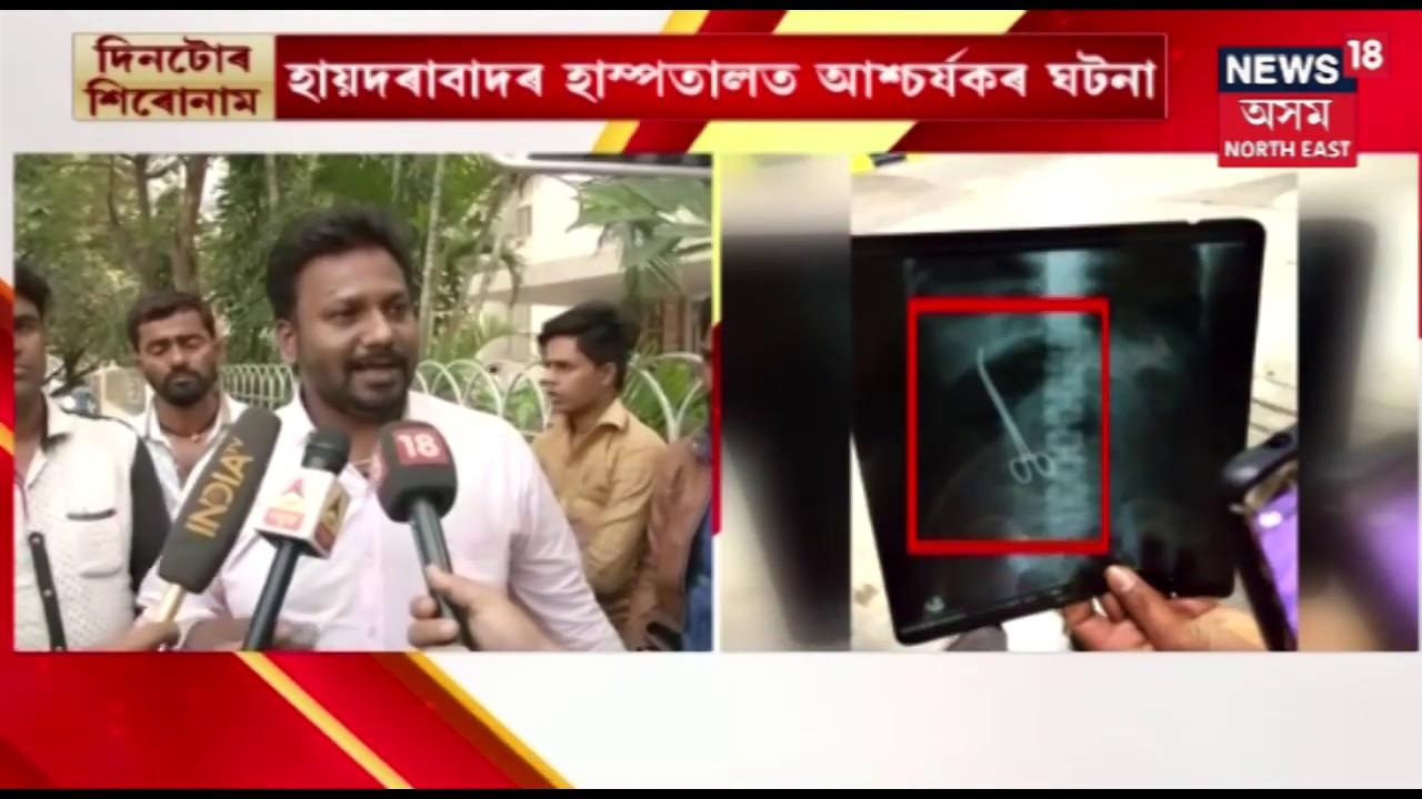 Shocking! Doctors Leave Scissors In Patient's Stomach During Surgery