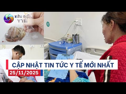 Bản Tin Y Tế 25/11: Nam 17 tuổi hôn mê vì u não – Cô gái 22 tuổi nguy kịch do sỏi bàng quang