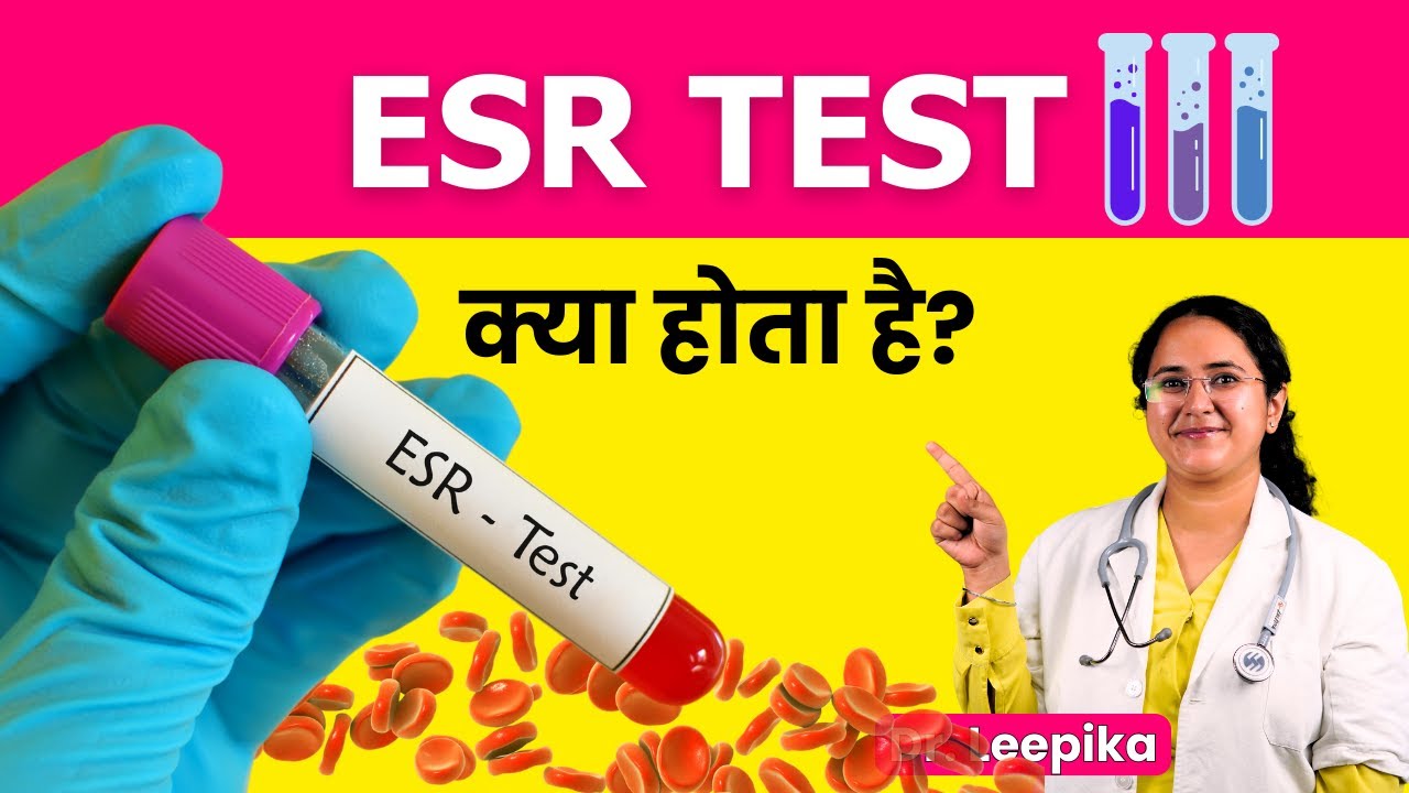 What Is ESR Blood Test In Hindi ESR Kya Hota Hai YouTube what-is-esr-blood-test-in-hindi-esr-kya-hota-hai-youtube