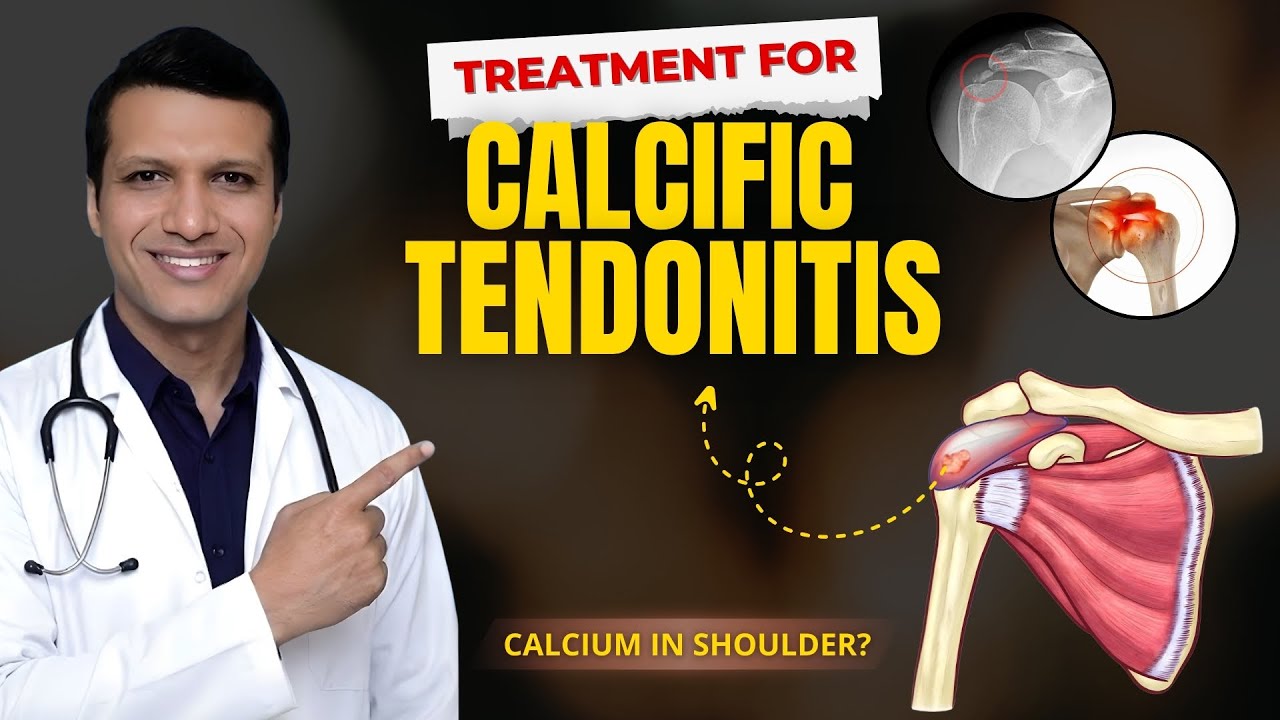 Shoulder Pain That Feels Like a Stone Inside? Calcium Deposit Explained & Treated