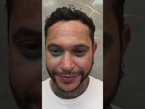 Eye Ball Leaked And Now Eye Ball Leak Removal