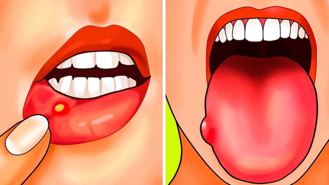 体が葉酸をもっと必要としている8つのサイン