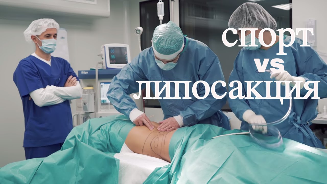 Липосакция // Как спасение от лишнего веса? - YouTube