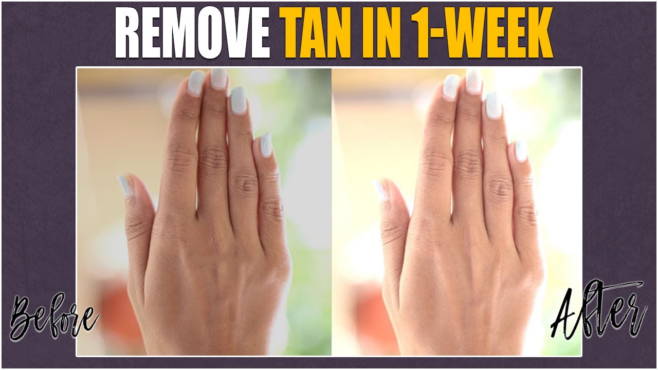 How To Remove Tan In 1week in Telugu / Skin Whitening Remedy In Telugu