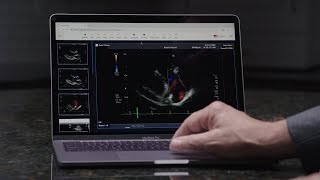 View, Share, and Manage Your Medical Images with mymedicalimages | Access Health