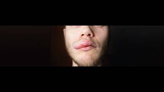 Angioedema screenshot 4