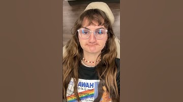 Getting implants with @smartarchesdentalimplants ♥️ #dentalimplant #newchapter #teeth