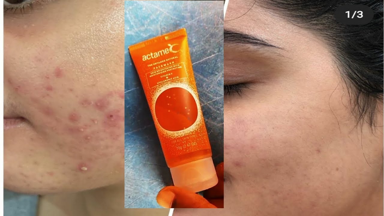 Actame C face wash skin Brightening wd Moisturizing protection All type