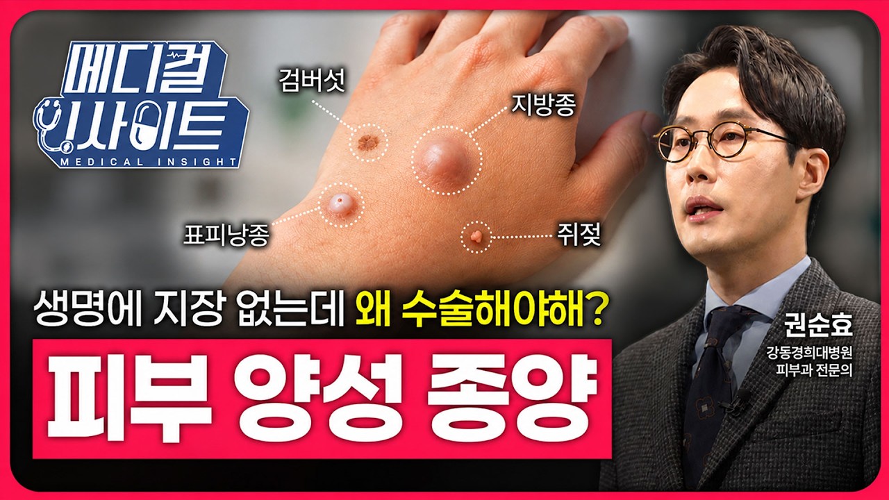 피부에 생긴 혹, 그냥 둬도 될까? 피부 양성 종양의 진단과 치료ㅣ메디컬 인사이트[105회]