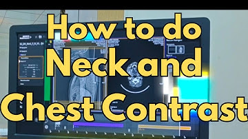 CT Scan Protocol: How to Perform Neck & Chest Contrast Study | Siemens Somatom go