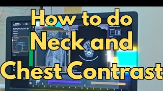 CT Scan Protocol: How to Perform Neck & Chest Contrast Study | Siemens Somatom go